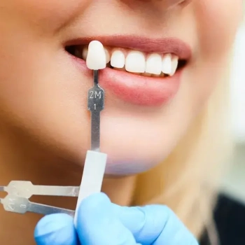 CEREC® Crowns & Veneers